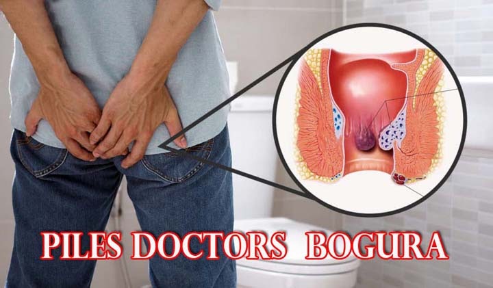 Piles Doctor in Bogura
